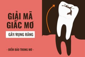 Nằm Mơ Rụng Răng Là Điềm Báo Dữ Hay Lành?
